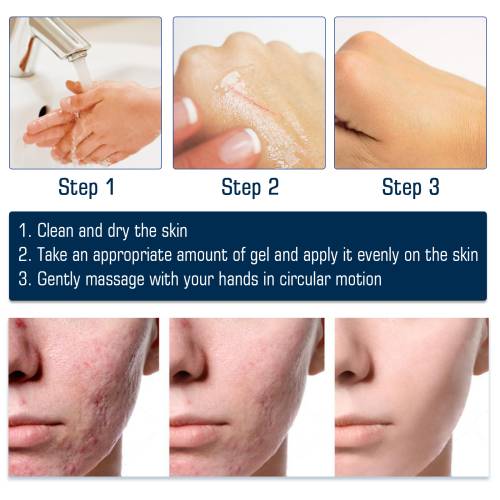 Silikone ar-gel