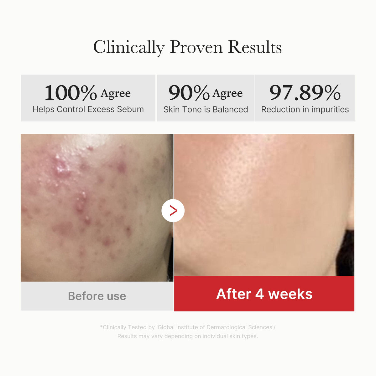 Eksfolierende toner-pads med ravsyre og panthenol til uren hud, 70 stk.