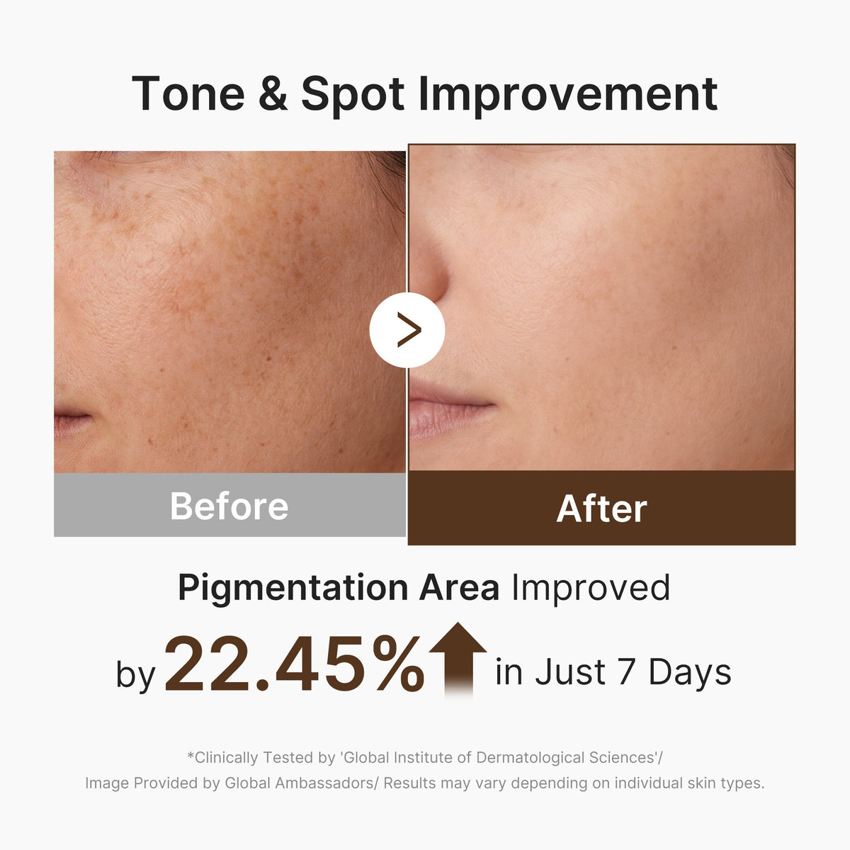 Plejesæt med ansigtsapparat i hvid, pads, ansigtsvand, serum og creme