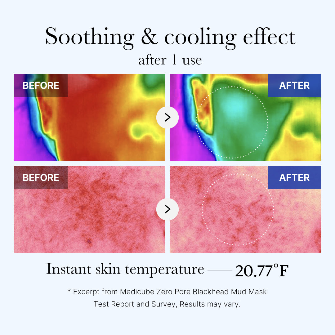 Lermaske mod hudorme med 5 typer ler samt AHA, BHA og PHA, 100 g