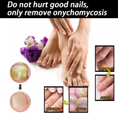 Panthenol neglplejevæske
