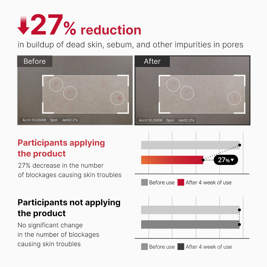 Eksfolierende kropsrens som spray med 32 % AHA, BHA, PHA og LHA, 110 g