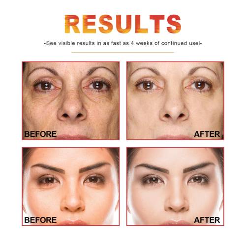 C-vitamin, retinol og hyaluronsyre serum