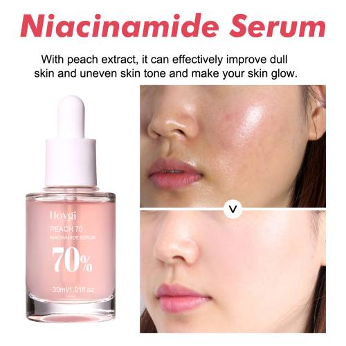 Niacinamid essens for finere porer