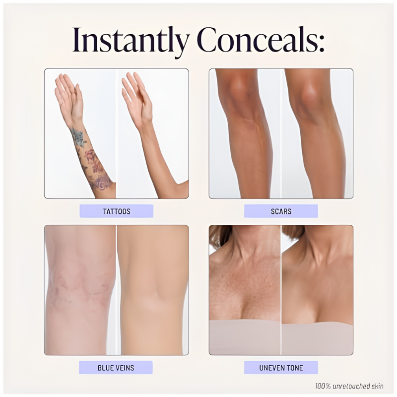 BodyConcealer: Legeme Fuld Dækning Perfektor Concealer With Børste