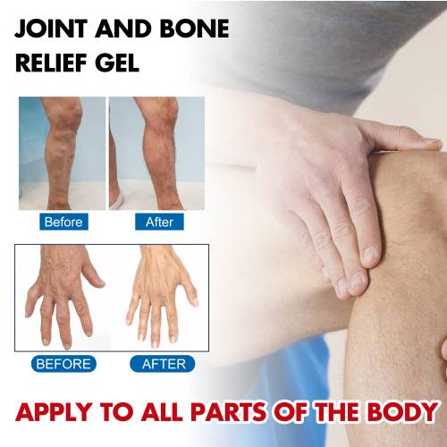 Arnika massagegel med glucosamin
