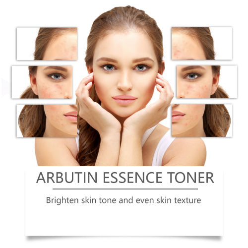Alfa-arbutin toner, ikke fedtet