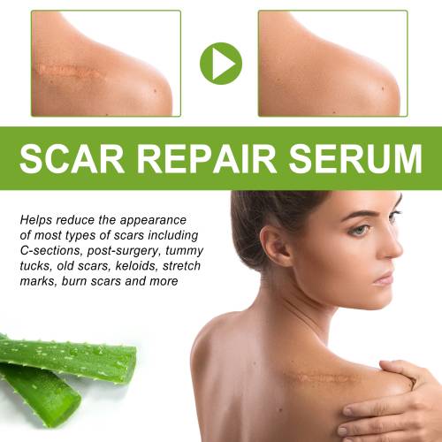 Niacinamid aloe hudserum