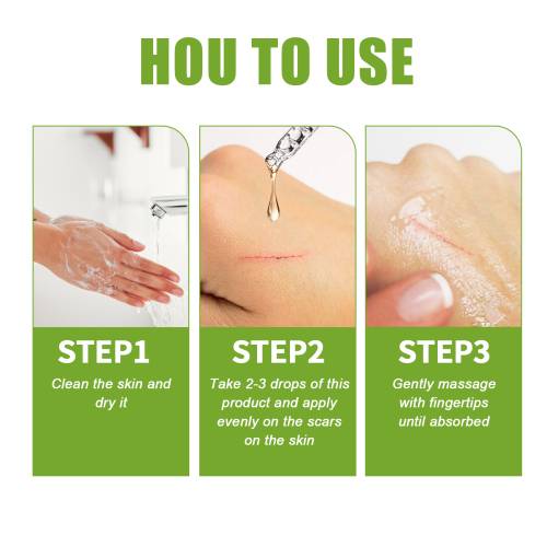 Niacinamid aloe hudserum