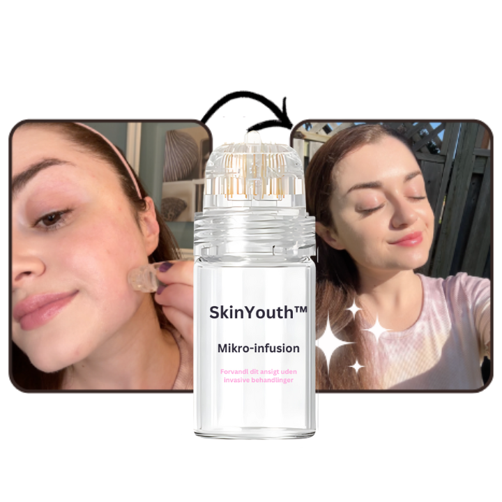 SkinYouth mikroinfusionsserum til kosmetisk hudpleje