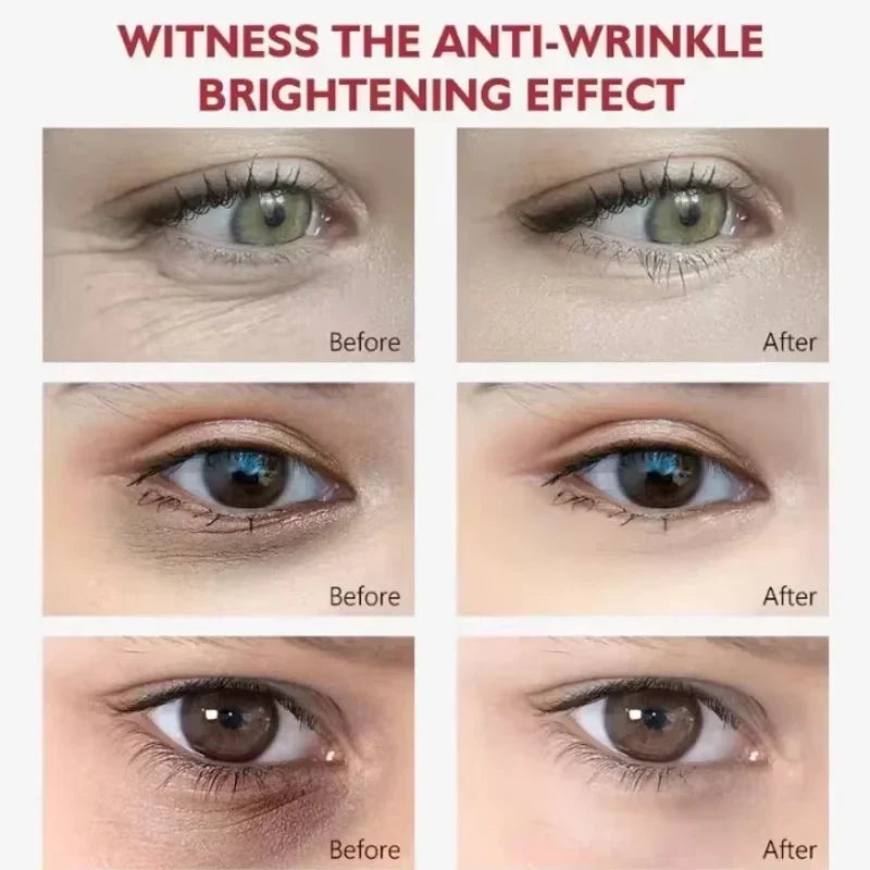 EyeCream 1+1 GRATIS: Hydrerende Opstrammende Anti-Mørke Rande Øjen Creme Serum