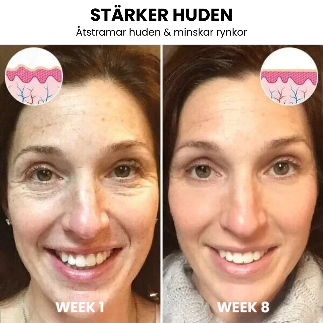 SkinLift ansigtsserum til fugt og glattere udseende