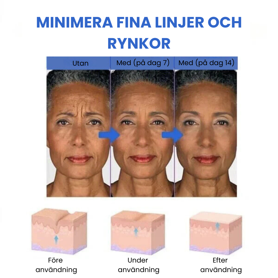 SkinLift ansigtsserum til fugt og glattere udseende