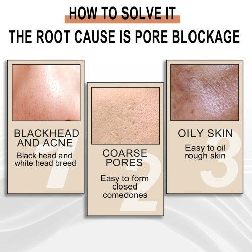 Glykolsyre peeling-essens mod hudorme