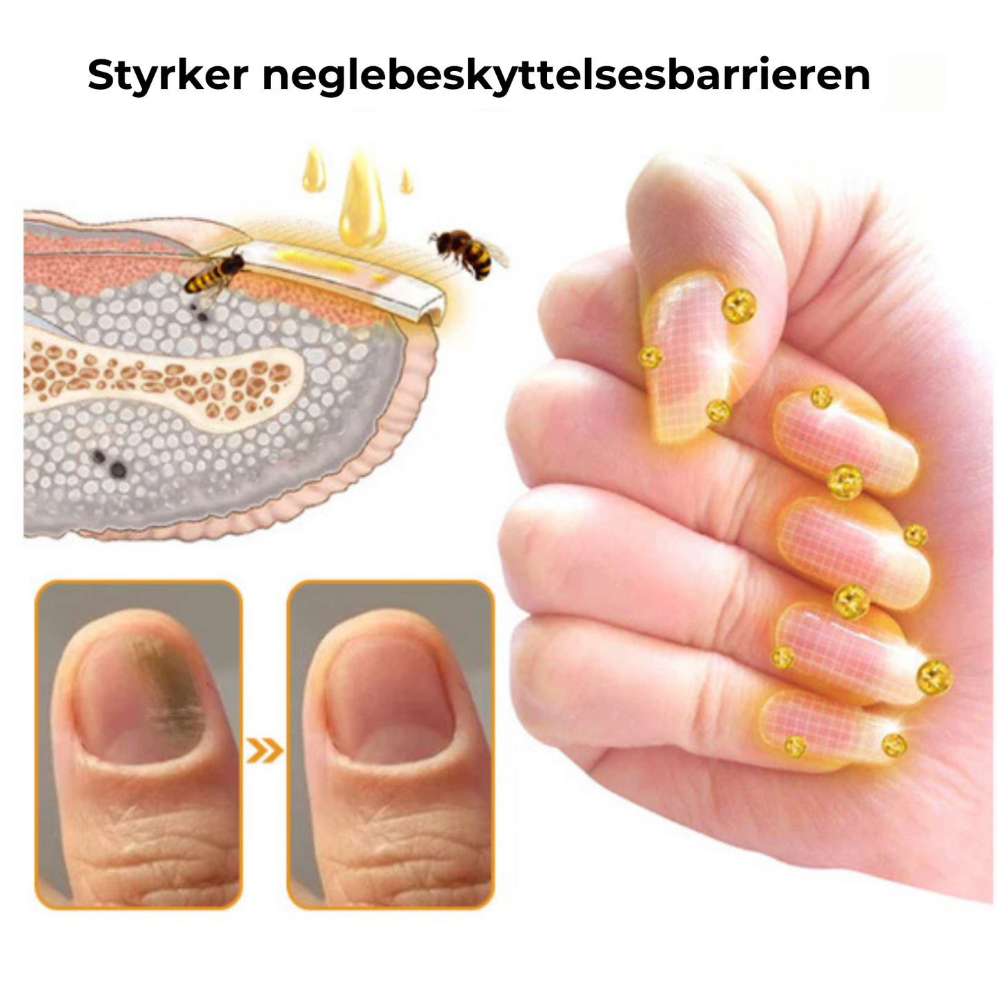 Negleskjold™ kosmetisk negleserum