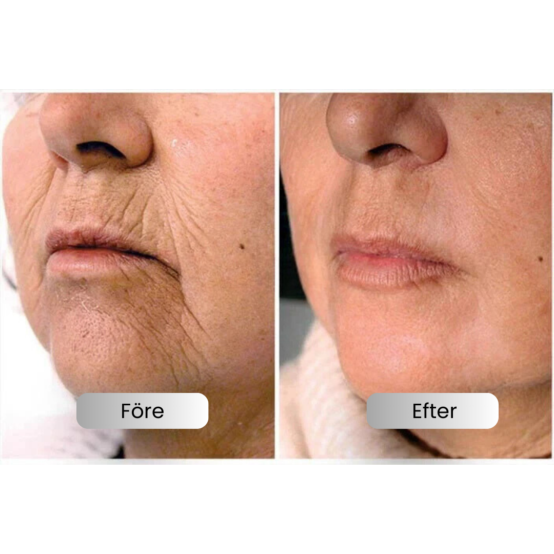 SkinLift ansigtsserum til fugt og glattere udseende