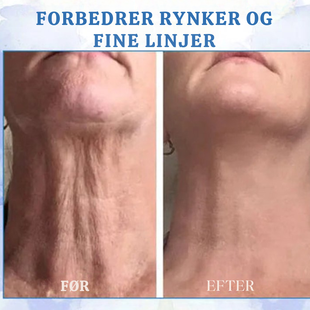 StramHud fugtgivende creme med niacinamid og hyaluronsyre