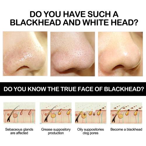 Bambuskul peel-off maske mod hudorme