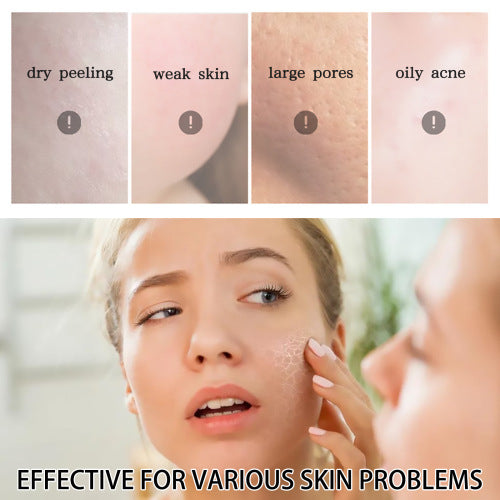 Aloe vera gelspray, kølende aftersun, 50 g