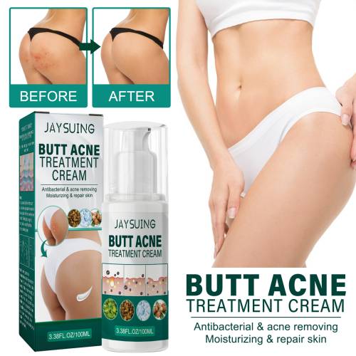 Ballecreme med sheasmør, klarende