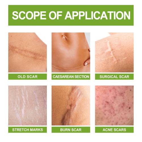 Niacinamid aloe hudserum