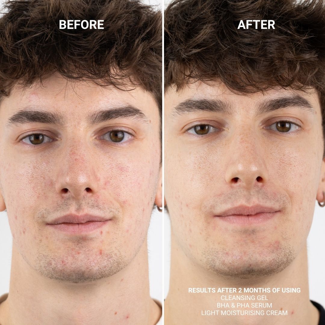 CLEANSING GEL (WITH 5% PHA)