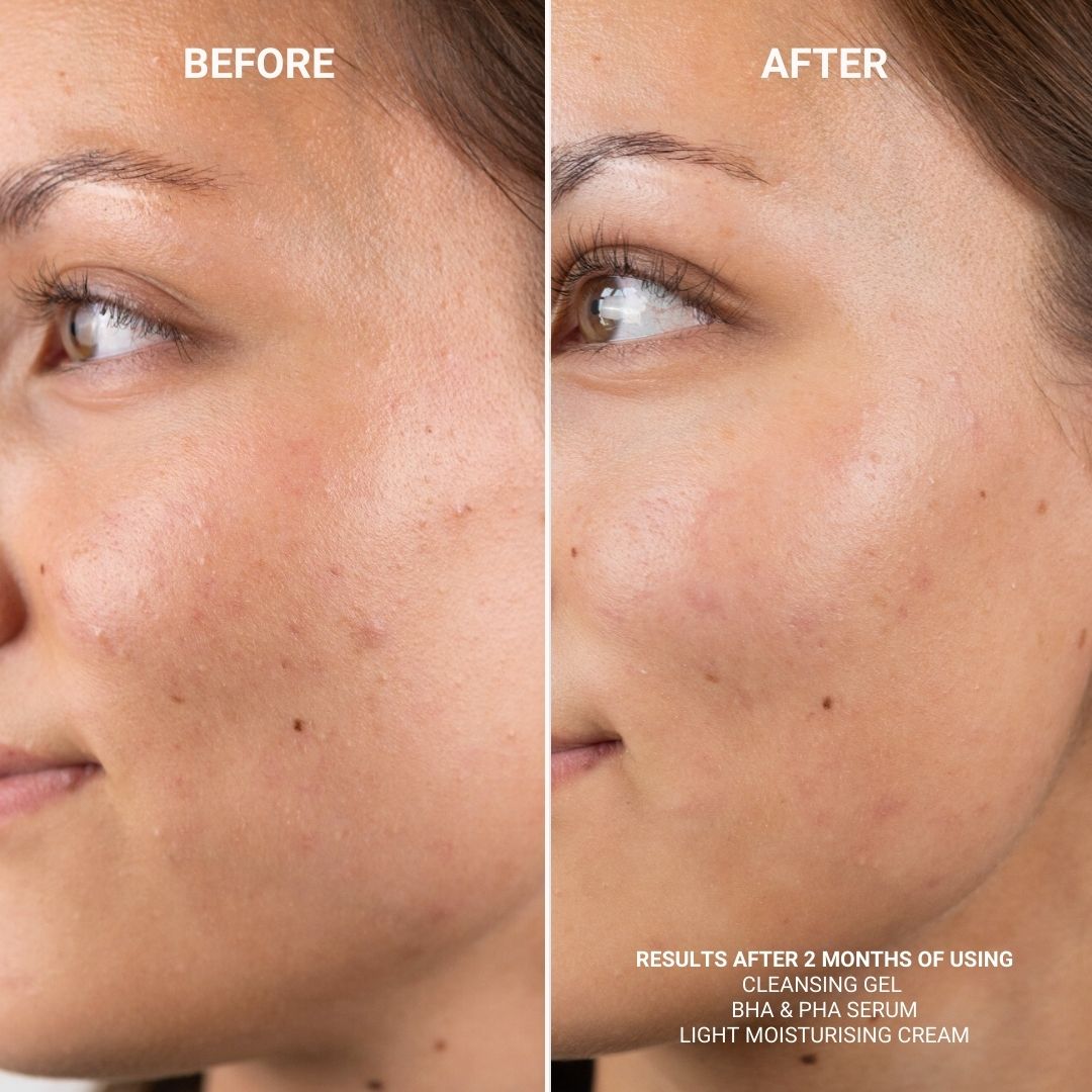 BHA & PHA SERUM