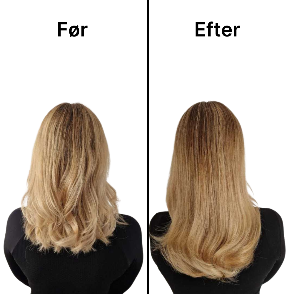 RelaxScalp Pro hovedbundsmassager med oliebeholder vist med tilbehør eller pakkeindhold