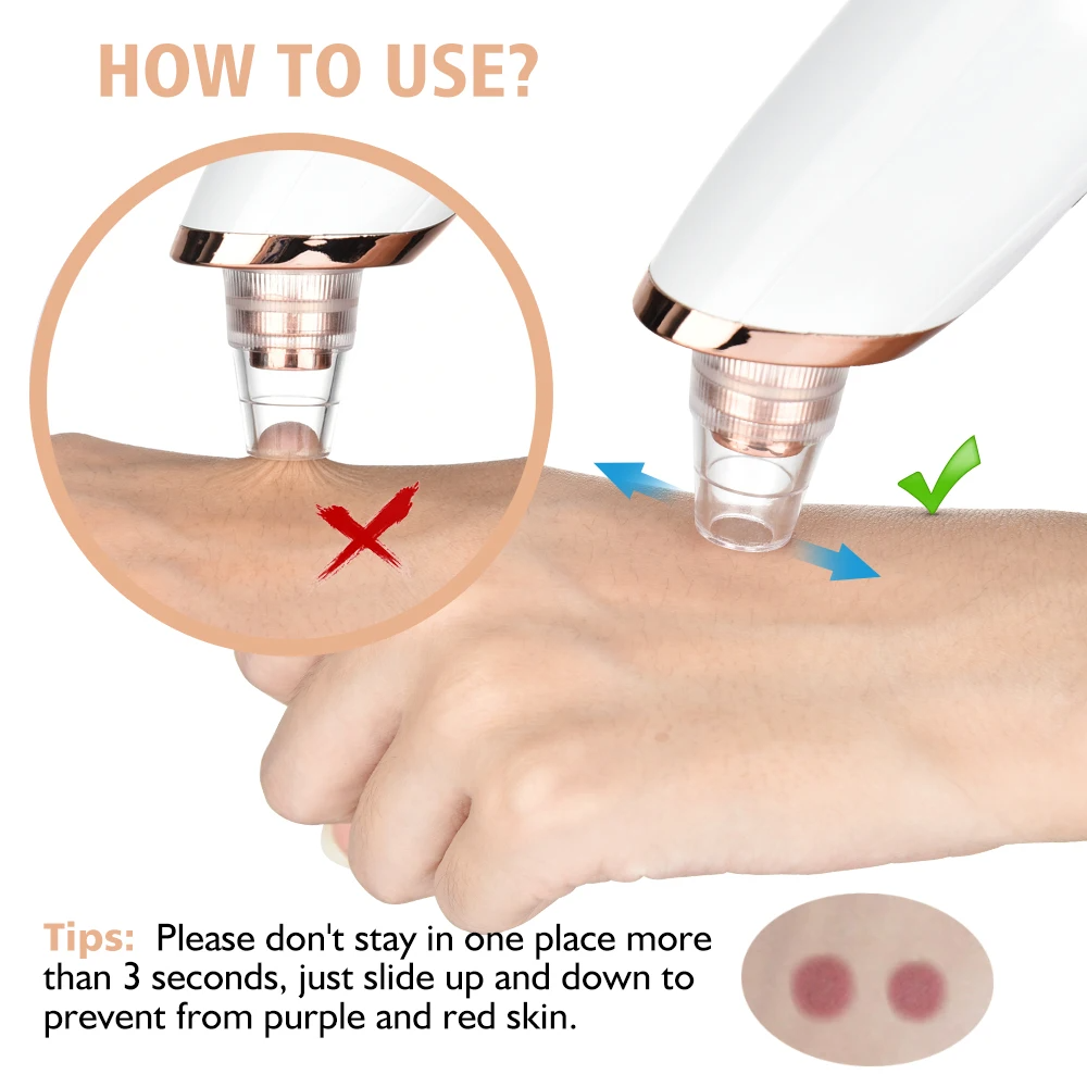 PoreRemover: Genopladelig Smart Hudorme, Hvide Hudorme Porer Fjerner Kit