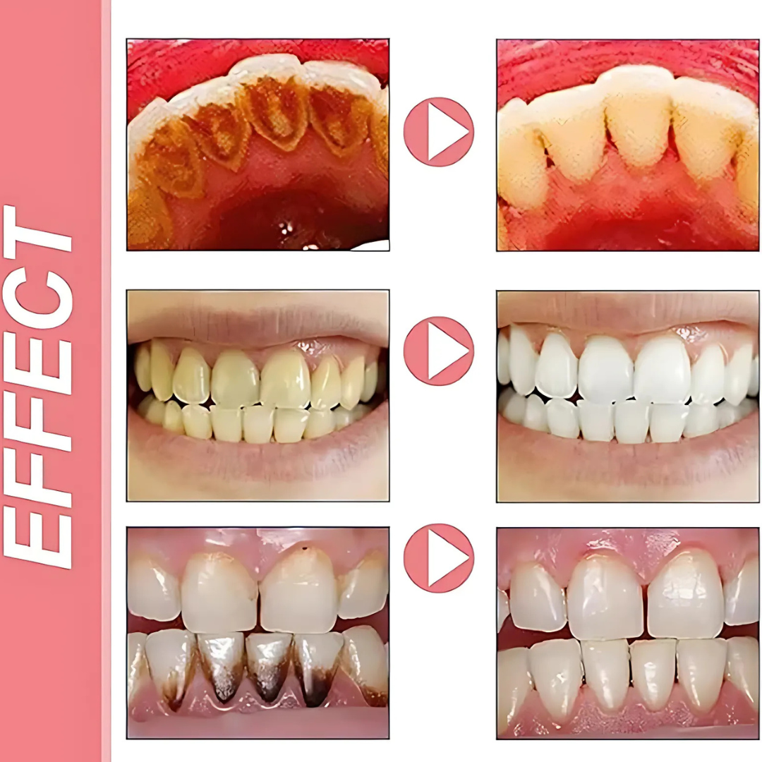 ProbioticToothpaste 1+1 GRATIS: Mild Hvidning Styrkende Probiotisk Tandpasta