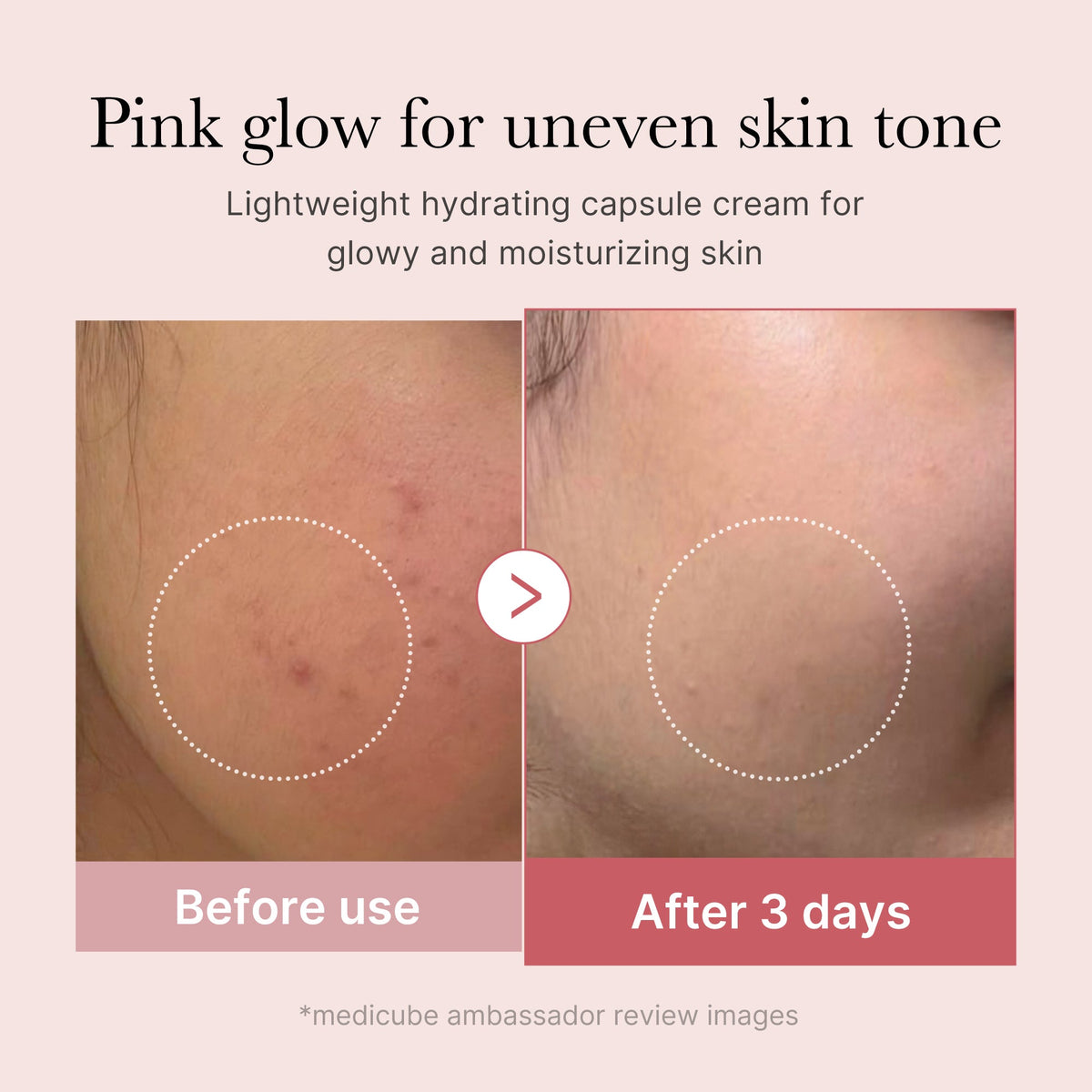 Hudplejesæt med ansigtsapparat, PDRN-serum, kapselcreme og pads