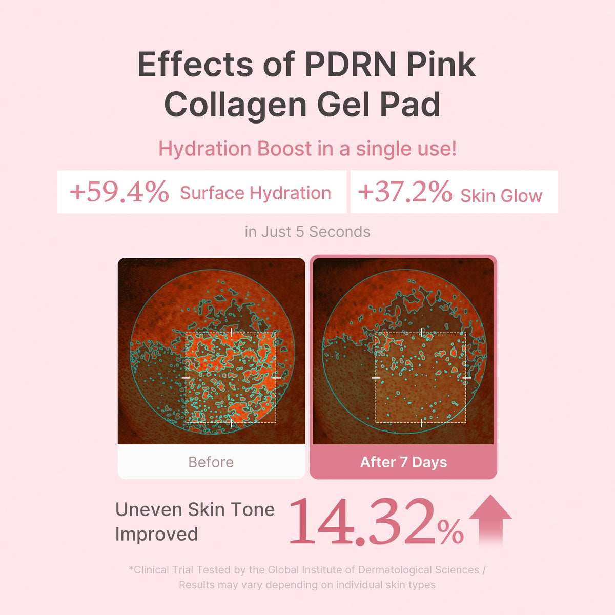 Hudplejesæt med ansigtsapparat, PDRN-serum, kapselcreme og pads
