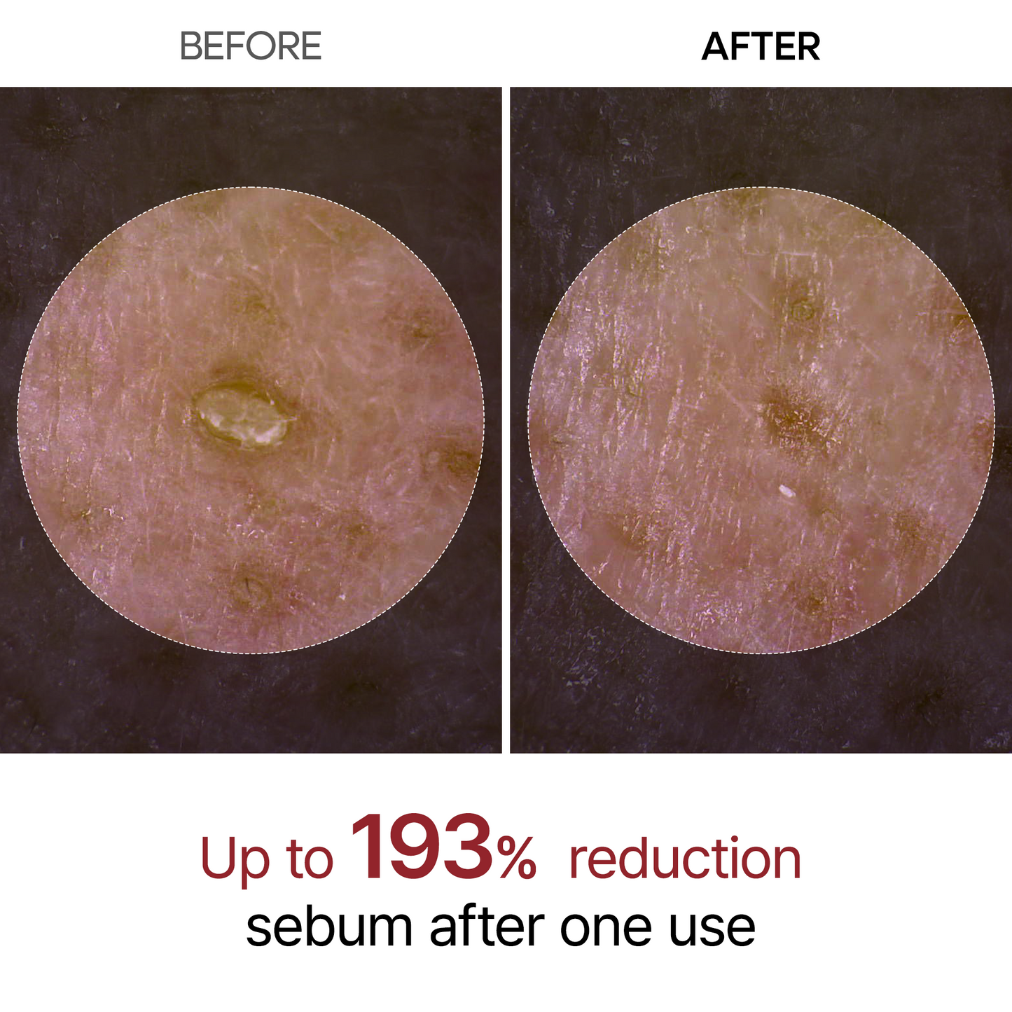 Peel Shot Glow – En lysende ansigtsserie med risekstrakter
