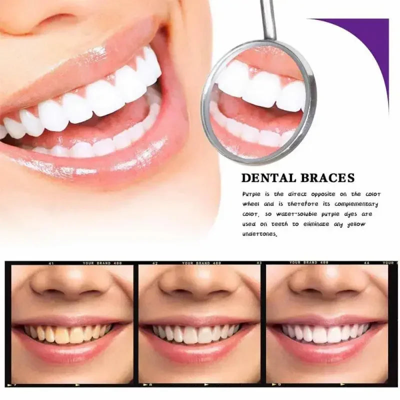 TeethSerum 1+1 GRATIS - Tænder Blegning Og Protection Serum