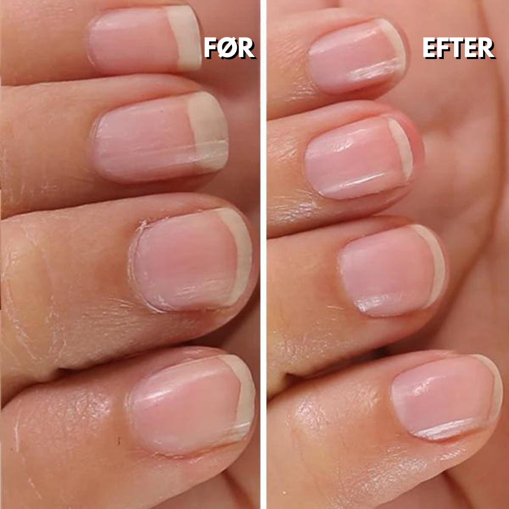 NailMaster Pro elektrisk neglefil med tilbehør vist med tilbehør eller pakkeindhold