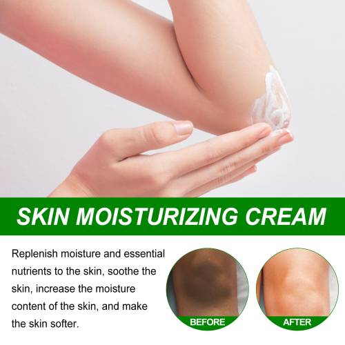 Creme til albuer og armhuler, 50 ml