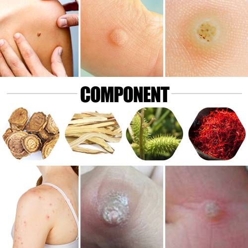 Urte fodplaster