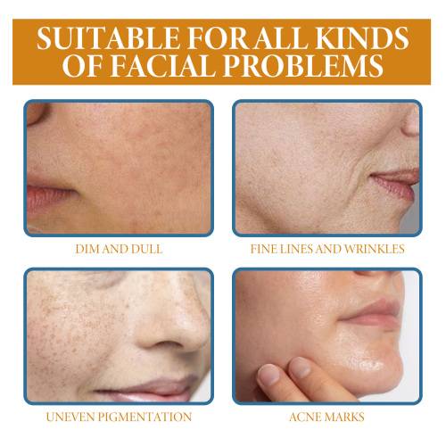 Retinol serum til fine linjer og ujævn tone