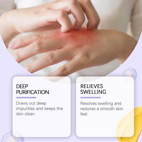 Propolis bodycreme med bivoks og allantoin