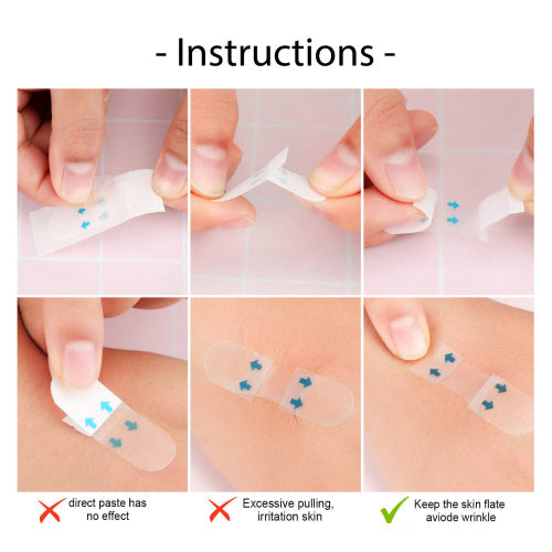 Usynlig V-line face-lift tape
