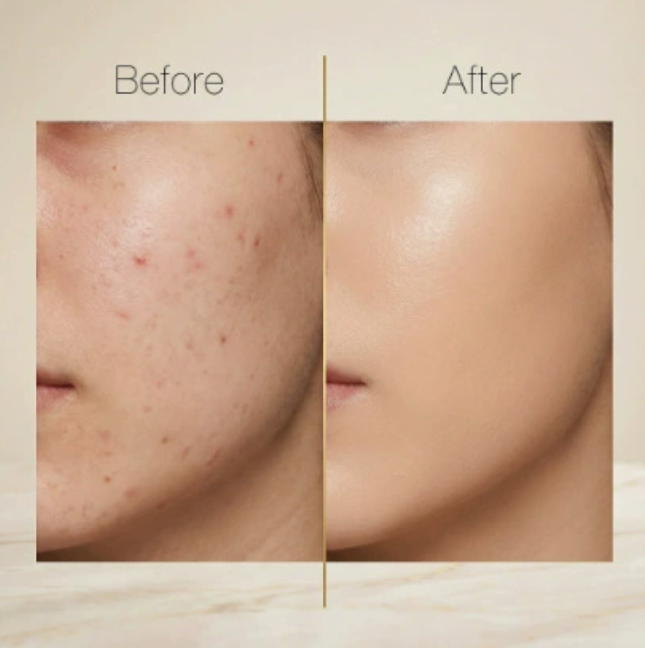 Let concealer med naturligt finish