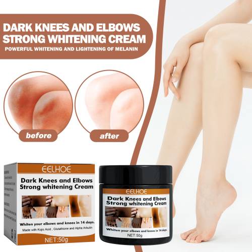 Creme til albuer og knæ med glutathion og kojisyre