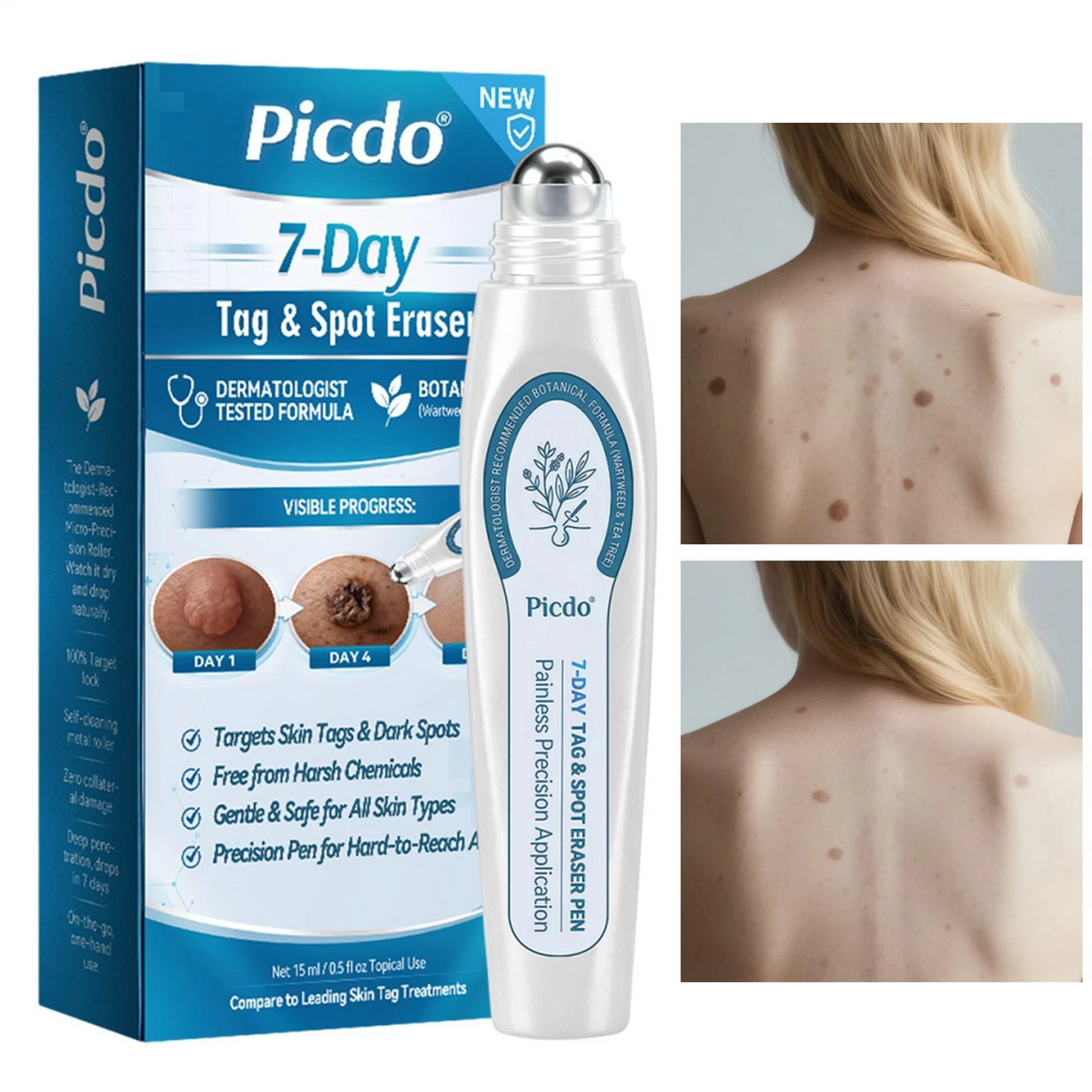 ClearRoller™ 1+1 GRATIS - Avanceret Klar Hud Forfinende Ffornyelse Roller Serum