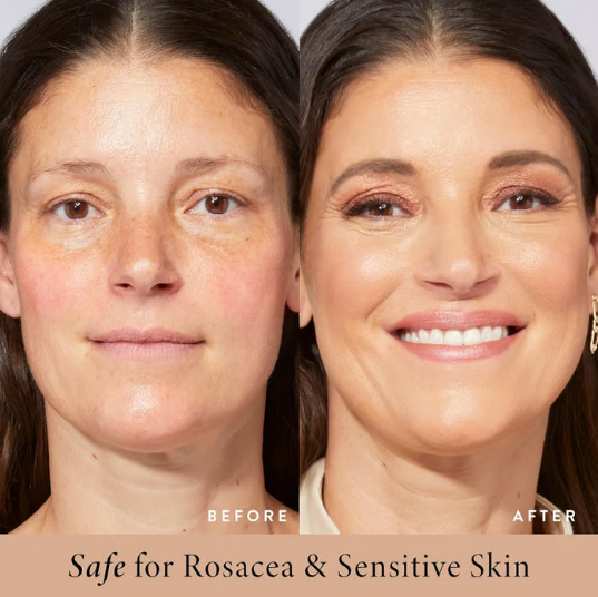 MoisturizerPrimer 1+1 GRATIS - Alt I Én BB-Farvet Fugtighedscreme, Primer Og Solcreme