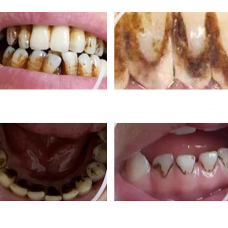 DentalCare – Let 360° Tandpleje Værktøjssæt Hjemme